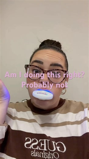 Teeth Whitening Day 1: My Real Before