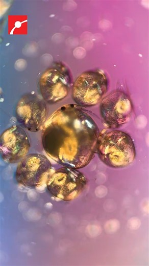 Microscopic Look at Lake Water