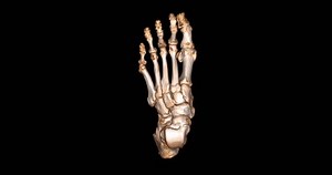 Ct Scan Foot 3d Rendering Diagnosis Stock Footage Video (100% Royalty-free) 1100695693 | Shutterstock