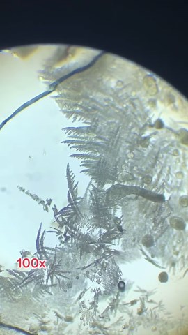 Amazing Crystal Formations Under the Microscope!