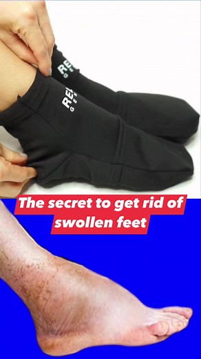 This is the quickest was to get rid of swollen ankles and feet. #fyp #viral #feet #podiatry #podiatrist | The Good Foot Doctor