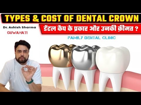 Types of dental crowns and cost in India ? Cost of dental crowns in Guwahati | Dr. Ashish Sharma