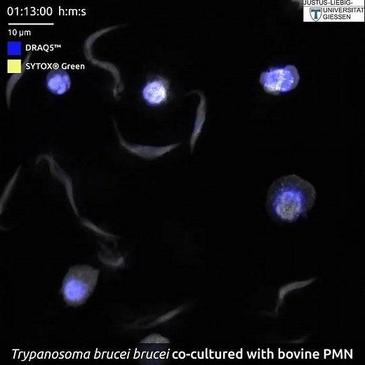 capturing netosis in real time