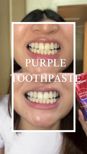 PURPLE TOOTHPASTE: Instantly Whiten Your Teeth with Colgate!