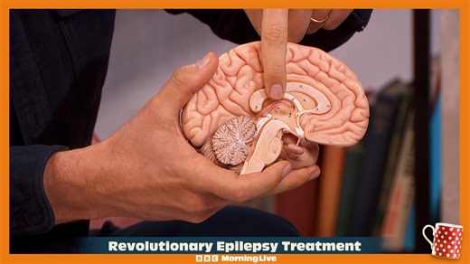 Figures show that 1 in 4 people newly diagnosed with epilepsy is over the age of 65, with 80 people being diagnosed every day. That means 20 people over 60 will be diagnosed with epilepsy today. But there are amazing developments on the horizon to help those who have the condition. Dr Xand explains how a bad taste in your mouth is an early warning sign you have the condition. To watch with subtitles, search for Morning Live on BBC iPlayer from 01/07/24. | BBC Morning Live
