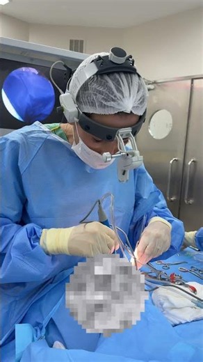 Amigdalectomia sem dor e com pós operatório tranquilo é possível com o uso do coblator