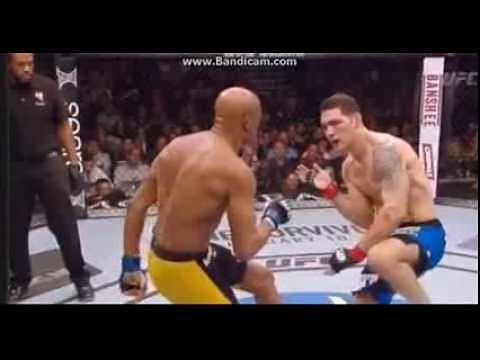 Anderson Silva Broken Leg