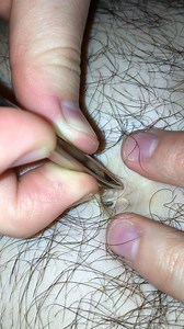 My boyfriend’s belly button. I was just as surprised as you are.