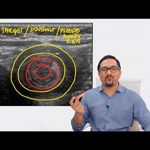 We are getting ready💪 For the biggest update of Marrow ever! Marrow Edition 4.0 - Coming soon. | Marrow