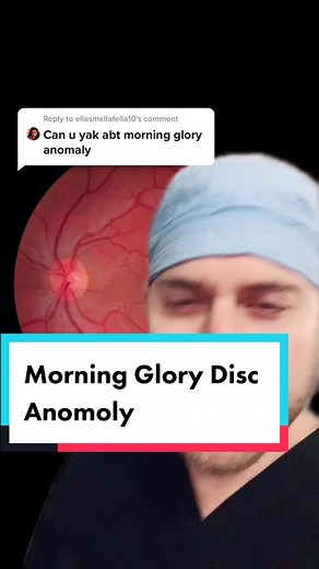 Understanding Morning Glory Disc Anomaly in the Eye