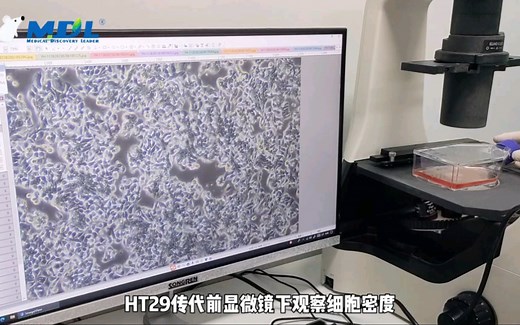 HT29细胞的传代过程