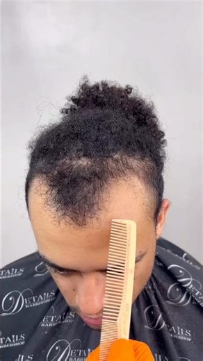 Bring back this boy's missing hair |#shortvideo