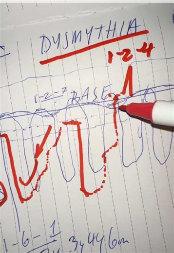 Understanding Dysmythia: Insights into Double Depressive Disorder