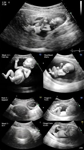 Fetal Development (2 to 12 Weeks) | Real Ultrasound Pregnancy Scan #pregnant #ultrasound #baby