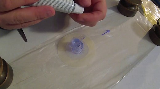 Kite Valve Replacement