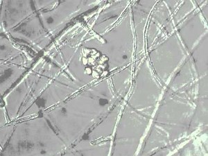 Pythium zoospore discharge