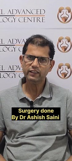 Drug coated balloon dilatation(optilume) for urethral stricture review