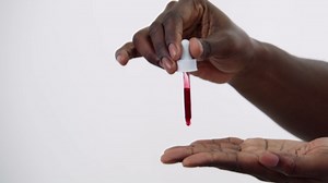 The Ordinary AHA 30% + BHA 2% Peeling Solution, Advanced Exfoliating Peel for Brighter Skin