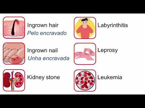 Curso de inglês passo a passo - Aula 205 - Diseases and health conditions part 2