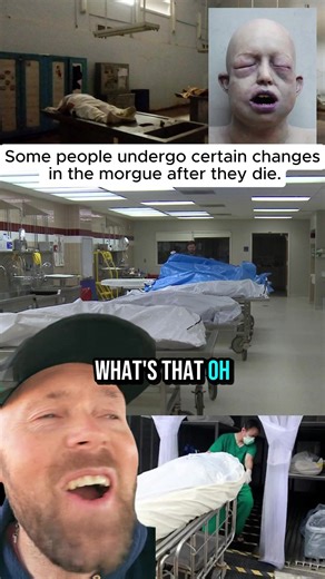 What Happens in the Morgue After Death?