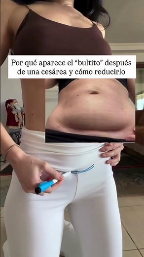 Muchas mamás después de una cesárea notan algo que les preocupa…