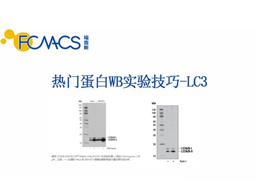 LC3蛋白检测成功经验汇总