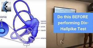 Do THIS before performing Dix-Hallpike Manuever