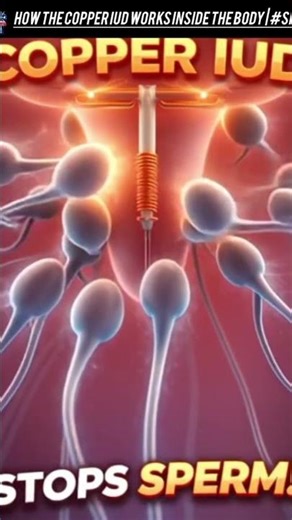 How the Copper IUD Works Inside the Body | #shorts