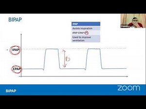 Non-Invasive Ventilation (NIV) Practical aspects by Dr. Chandana Karunarathne
