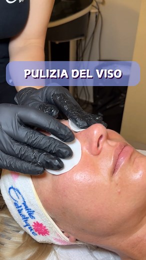 La pulizia del viso professionale è fondamentale per una pelle sana e luminosa. Affidarsi a esperti di un centro estetico garantisce un’analisi accurata della pelle e trattamenti personalizzati. Grazie a tecniche avanzate e prodotti specifici, si eliminano in profondità impurità e cellule morte, stimolando la rigenerazione cellulare e migliorando la luminosità del viso. Un gesto di bellezza e benessere per la salute della pelle. #emilieesthetiquepalermo #centroestetico #estetica #palermo #viso #