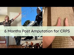 What A CRPS Warrior's Life Like 6 Months After Amputation (A Day in the Life)
