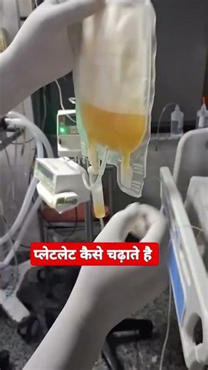 Platelet Transfusion Procedure | प्लेटलेट ट्रांसफ्यूजन कैसे करें #shortvideo #platelet #icu