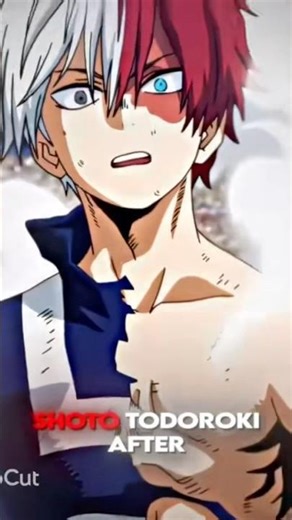 Shoto Todoroki Before And After Edit.