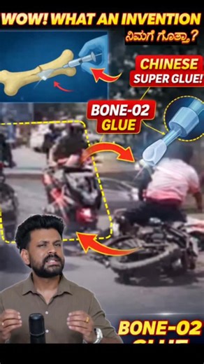 ನಿಮ್ಮ ಮೂಳೆಗಳು ಒಡೆದ್ರೆ Bone-2 Glue ಅಂಟಿಸಬಹುದಾ? 😱 ಇದು ನಿಜನಾ? ಅಥವಾ ಪೂರ್ತಿ ಸುಳ್ಳಾ? ಈ ವಿಡಿಯೋ ನೋಡಿ, ವೈದ್ಯಕೀಯ ಸತ್ಯ ಏನು ಅಂತ ತಿಳ್ಕೊಳ್ಳಿ! 🦴🧠 ಇಂತಹ ಶಾಕ್ ಫ್ಯಾಕ್ಟ್ಸ್ ಗಾಗಿ ಫಾಲೋ ಮಾಡಿ 🔥 #KannadaReels #KannadaFacts #HealthFactsKannada #MedicalFactsKannada #KannadaViral | The Info Monster