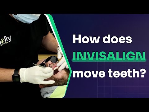 How does Invisalign move teeth? | Invisalign attachments - Step-by-Step Guide