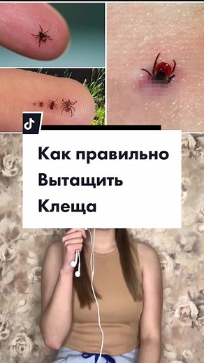 Understanding Ticks on Human Skin: Identification and Risks