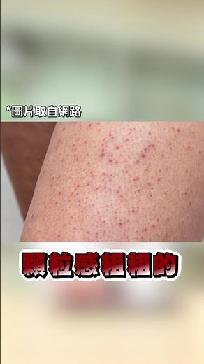 如何改善毛囊角化症？ | Dr.Hsieh達特醫
