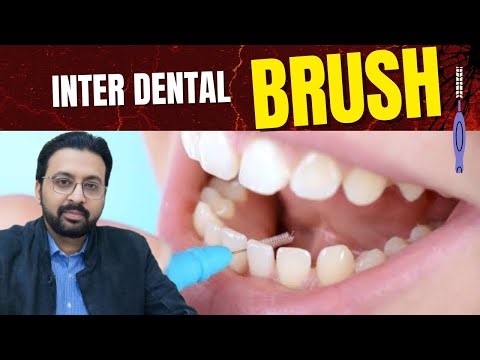 Remove Plaque Between Teeth FAST | Stop Tartar Before It Hardens