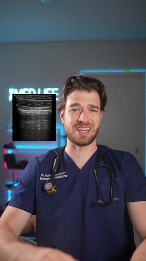 Understanding Ultrasounding Fluid in the Lungs: A Comprehensive Guide