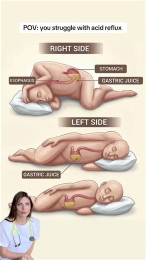 Sleep on Your Left Side? Here’s Why It Helps 😴
