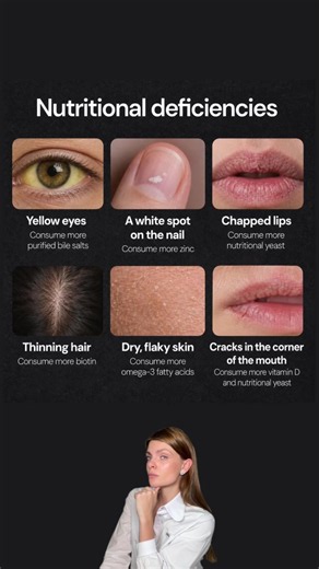 Nutritional Deficiencies: What Your Body Needs