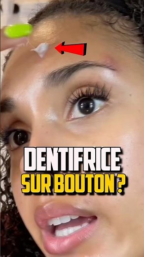 PUTTING TOOTHPASTE ON A PIMPLE?!