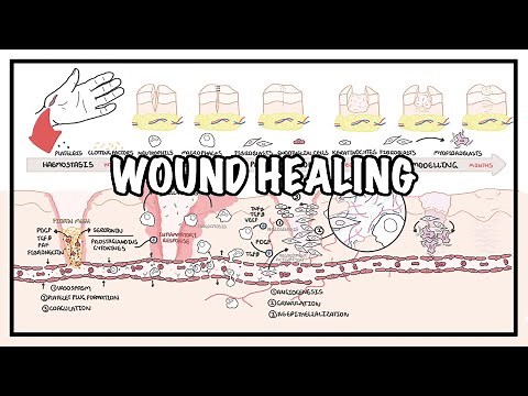 Wound Healing - Stages Of Healing And Pathology • Video • MEDtube.net