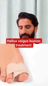 Hallux valgus (Bunion) Treatment at home