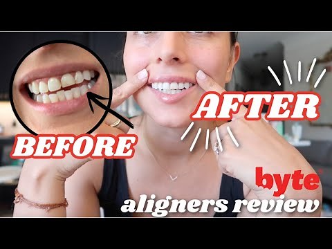 BYTE ALIGNERS REVIEW | progress + byte aligners before & after