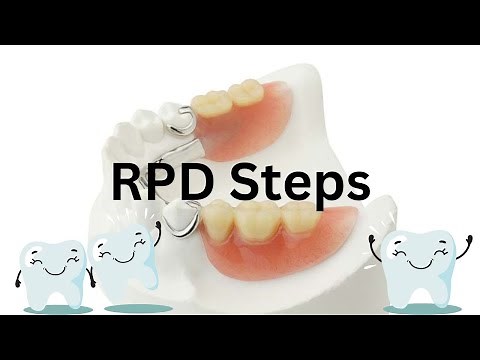RPD step by step procedure (SIMPLIFIED)