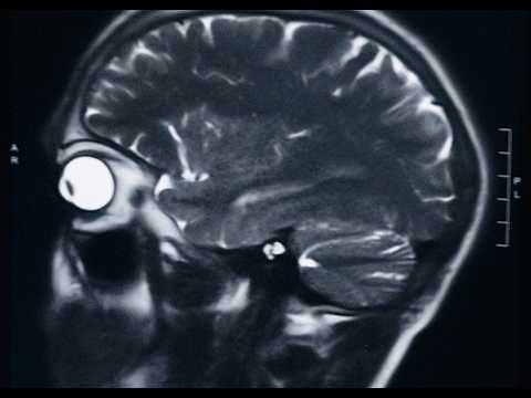 Reversion (Super 16mm Short Film)