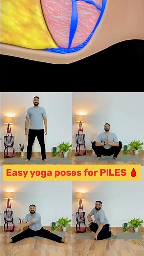 Say Goodbye to Piles! Easy Yoga Poses for Instant Relief 🧘‍♀️ #piles
