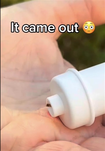 Watch what happens when you use Bug Bite Thing to remove a splinter… 👀🪵 Not just for bug bites — the suction tool can help remove stubborn splinters, too. One tool. So many uses. 🙌 Save this for the next time you’re dealing with a splinter, or share it with someone who needs this tip! #bugbitethingsuctiontool #bugbitething #splinterremoval #splinterhack
