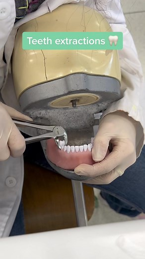 Teeth extractions 🦷 #dentist #extractions #surgeon #dentiststudent❤️🦷 #dentistry #fyp #surgery